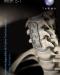 El Sistema de fusión cervical anterior Biodegradable Inion S-1 ™