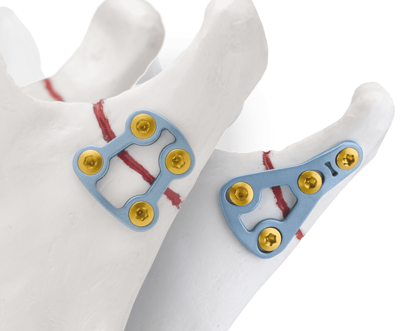Temporo-Mandibular